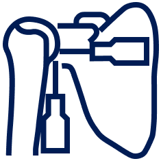 Shoulder Arthroscopy